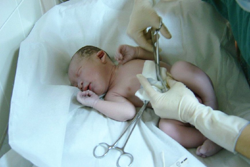 医生剪断脐带,新生儿剪断脐带