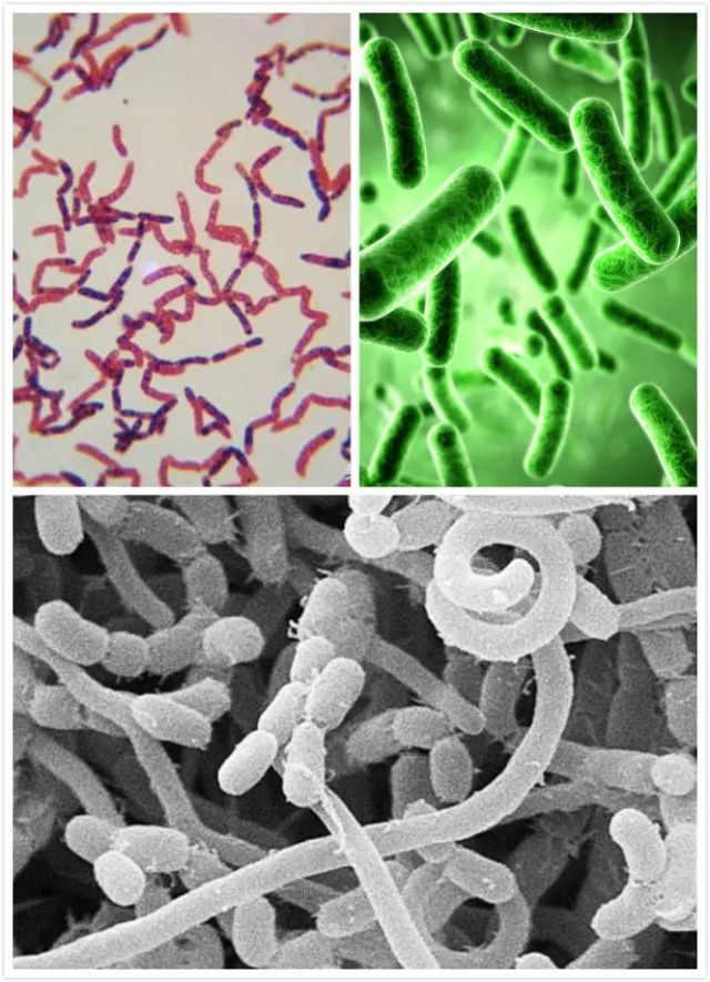 马桶清洁除味消毒去菌,马桶除菌和杀菌