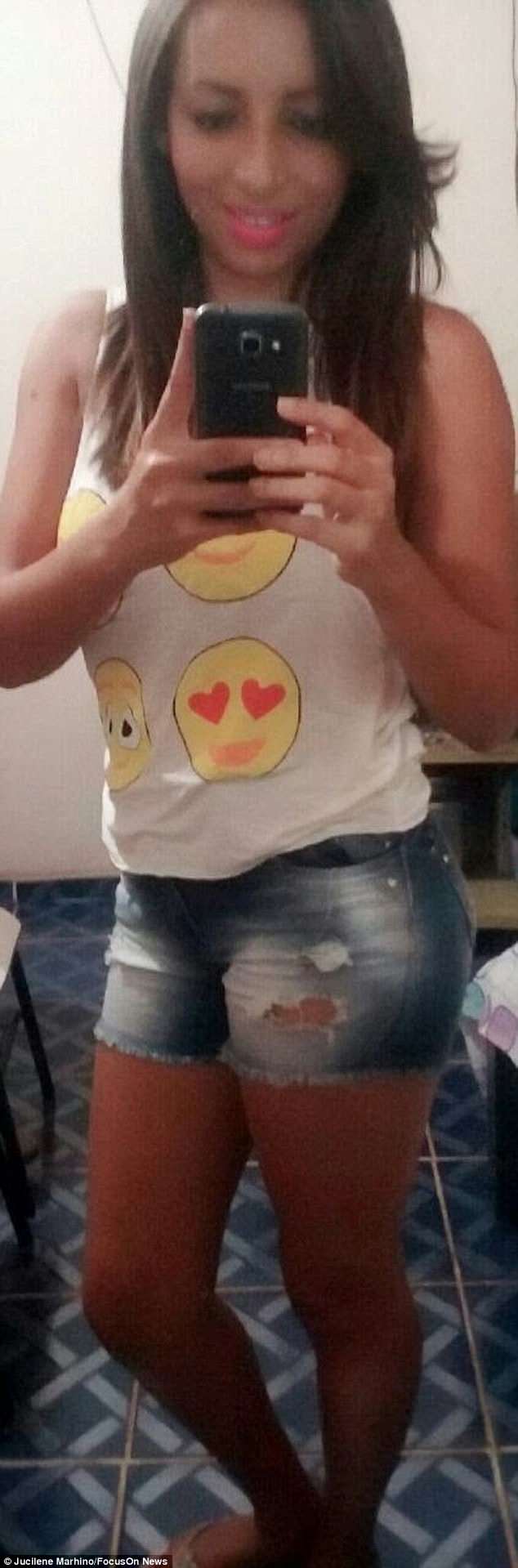 全球首例！巴西女子成功安装鱼皮阴道，已与男友开始幸福生活