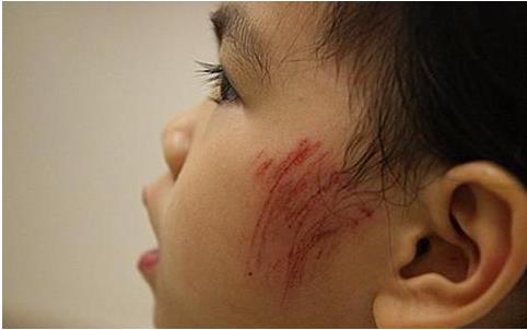 六种家庭常备消毒用品你用对了吗？