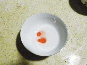 爸爸是b型血妈妈是a型血孩子血型,妈妈a型血爸爸是b孩子是什么血型