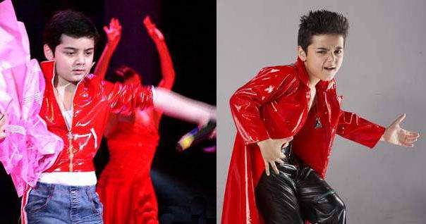 童星阿尔法回应脱发,阿尔法脱发