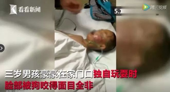又是遛狗不牵绳！泰迪起身走了两步吓得老人摔成9级伤残，狗主人被判赔20万！