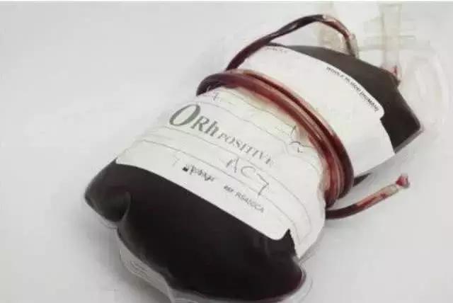 世界上什么血型比熊猫血还重要,世界上有比熊猫血还稀有的血型吗