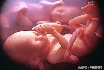 多胎妊娠早期致命吗,为什么会多胎妊娠