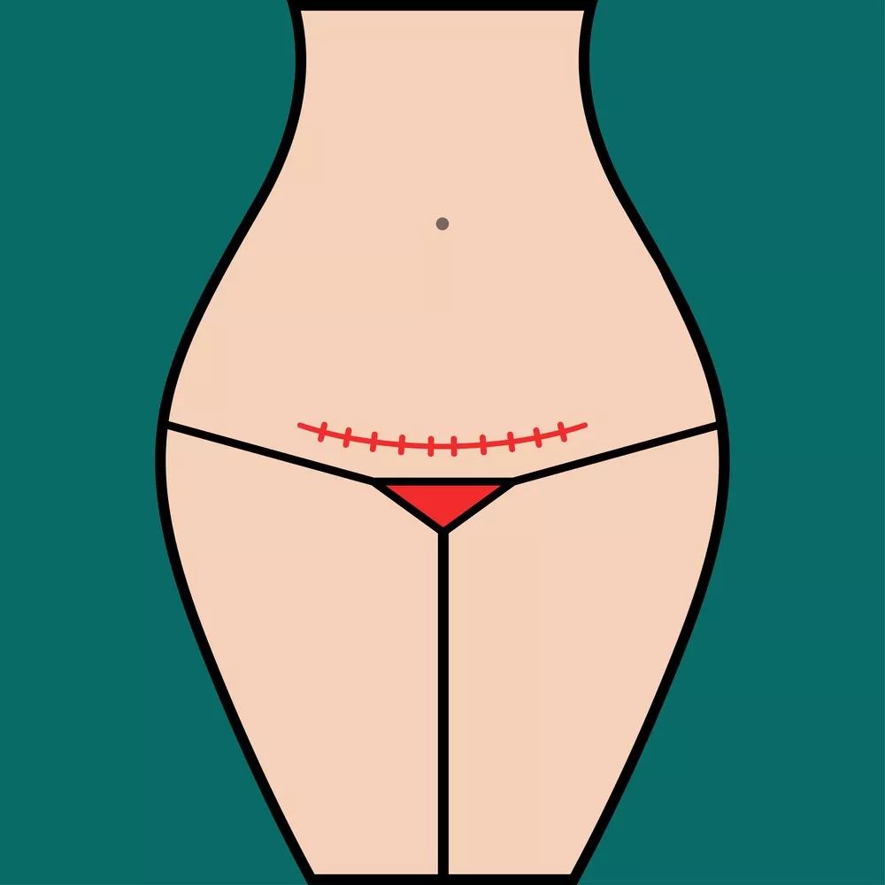 产后一定要42天复查吗可以推后吗,产后42天复查医生要求做盆底康复