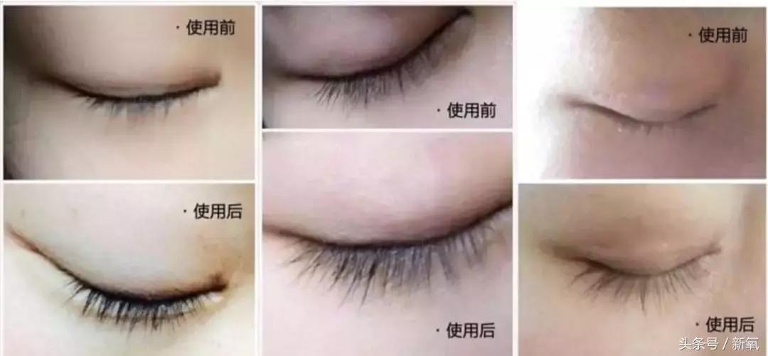 睫毛增长液排雷,睫毛增长液是不是前半瓶有效果