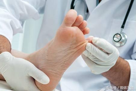 脚气病平时要注意什么,脚气有什么不可以吃的