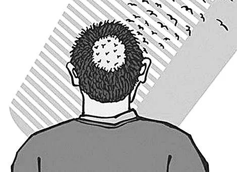 脱发难题100道,脱发题