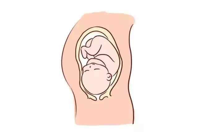 停胎有什么挽救方法吗,停胎是什么感觉