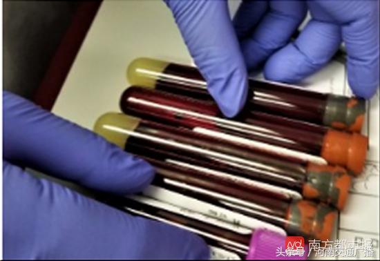 27岁小伙被诊断活不过100天,27岁小伙被诊断活不了100天