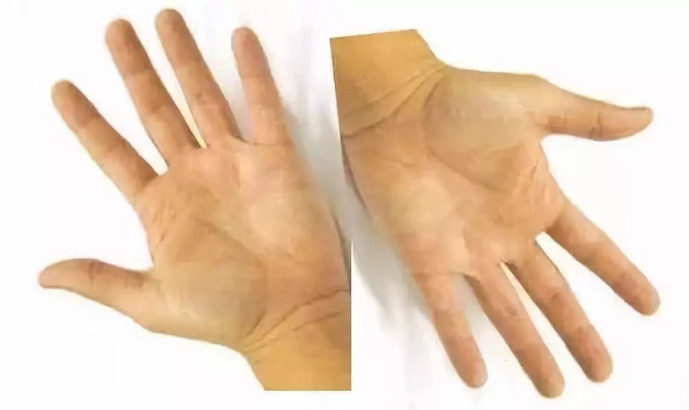 十指连心经络拍手操,十指连心拍手操完整版