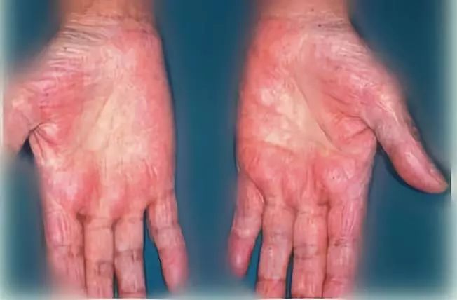 十指连心经络拍手操,十指连心拍手操完整版