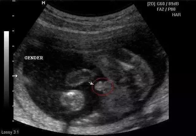 恩哥聊健康孕早期,恩哥聊健康孕前检查