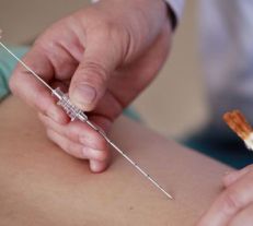 甘肃省中医院耳鼻喉科中医药特色治疗过敏性鼻炎显优势