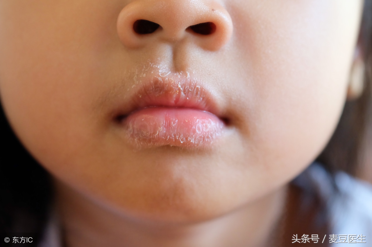 如何解决孩子的心病,儿童先心病最佳治疗方案