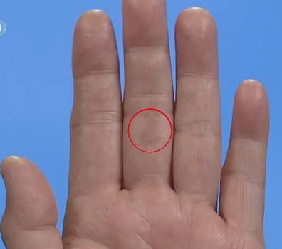 手上的健康秘密,手诊10种常见病从手上就能看出来