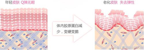 脸部肌肉下垂怎样变得紧致医美,脸部肌肉下垂怎么办