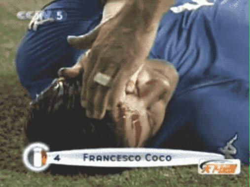 看世界杯真实反应,看世界杯后遗症