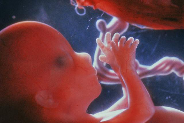 羊水过多过少有什么影响,怎样知道羊水过多或过少