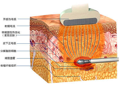 瘦身不瘦脸的运动,躺着就能瘦的神奇瘦身法