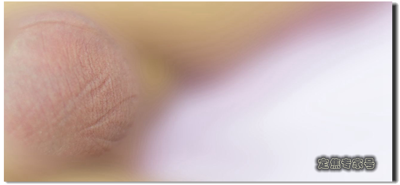 医生告知宝宝一侧*丸睾**扭转坏死，宝妈却扭头让宝宝叫旁边孩子哥哥