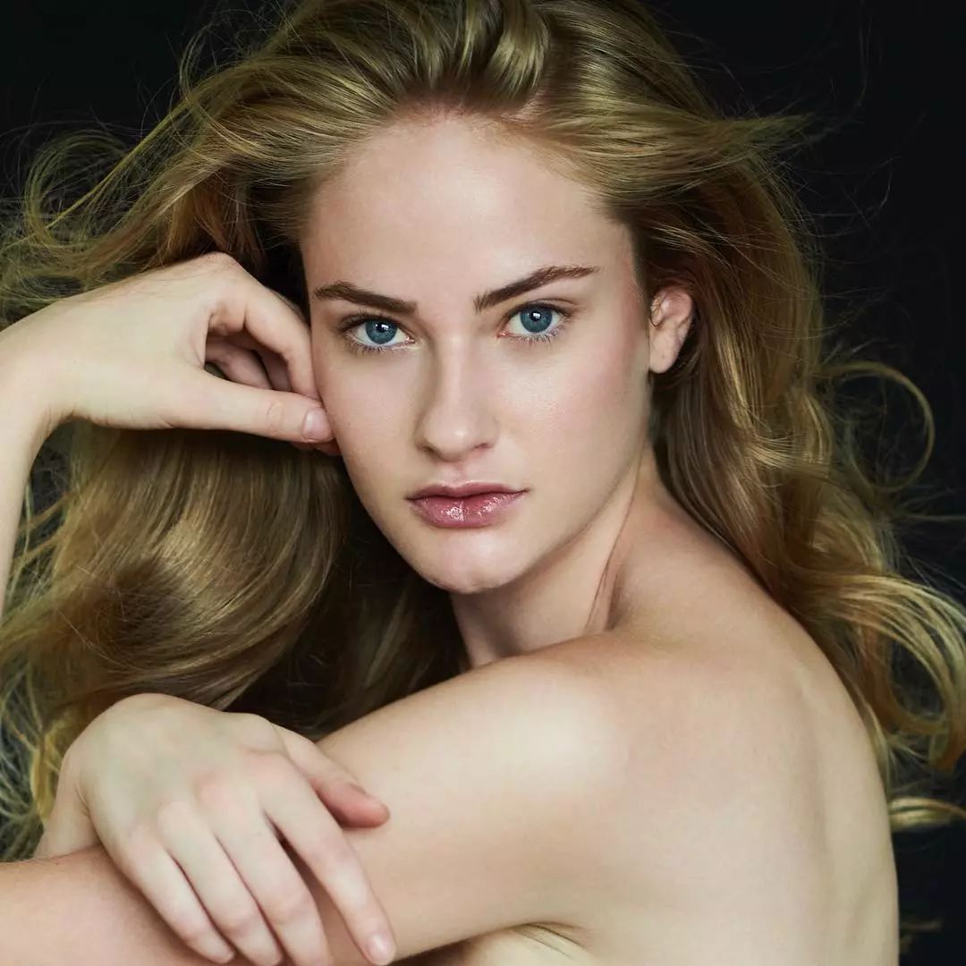 夏季有太阳皮肤就瘙痒,夏季衣服有毛怎么办