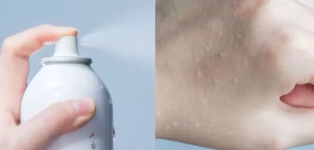 夏天保湿喷雾水小瓶,十大公认好用的保湿喷雾