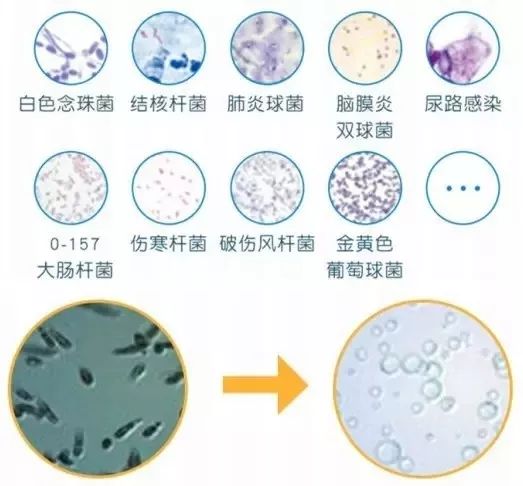 洗衣机里放多了清洁液全是泡泡,洗衣机里放点盐