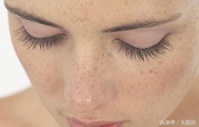 祛斑后涂哪种防晒霜比较好,祛斑效果最好的防晒霜