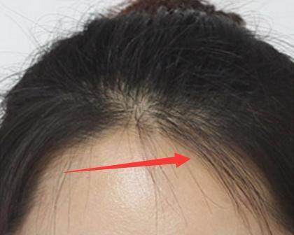 碎发多的女生可以怎么整理碎发,一招教你搞定碎发大人小孩都能用