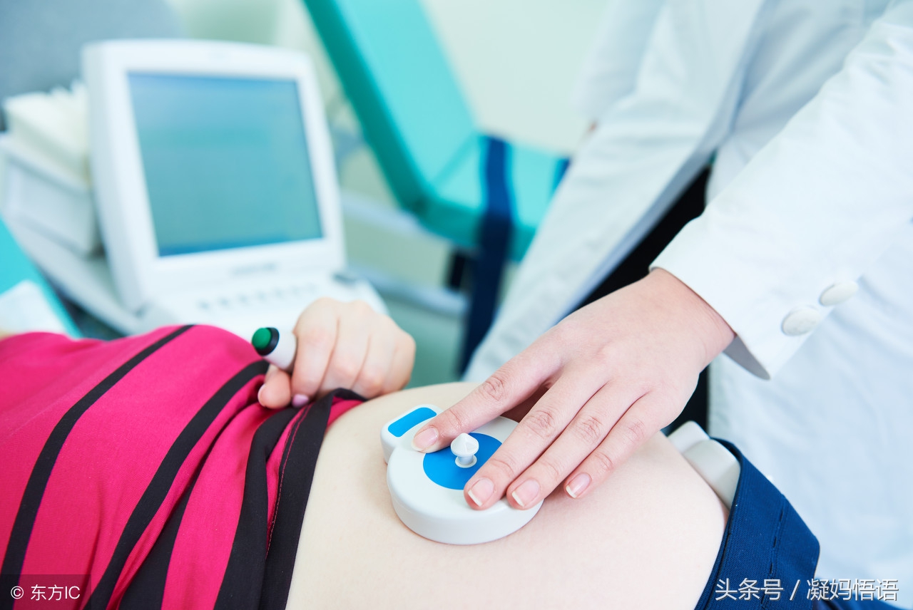 胎心监护不过有必要一直做吗,胎心监护到底要怎么过