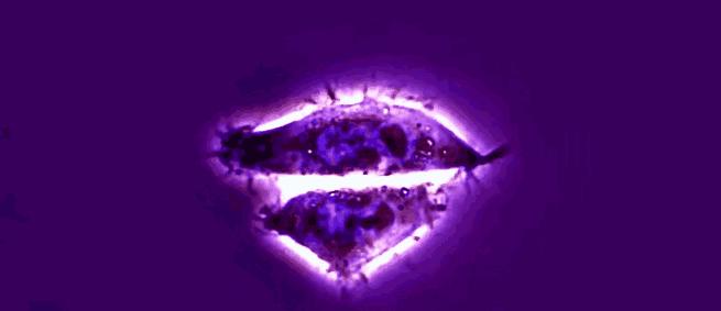 这些细胞害死了主人之后，又在实验室里繁殖了18000代