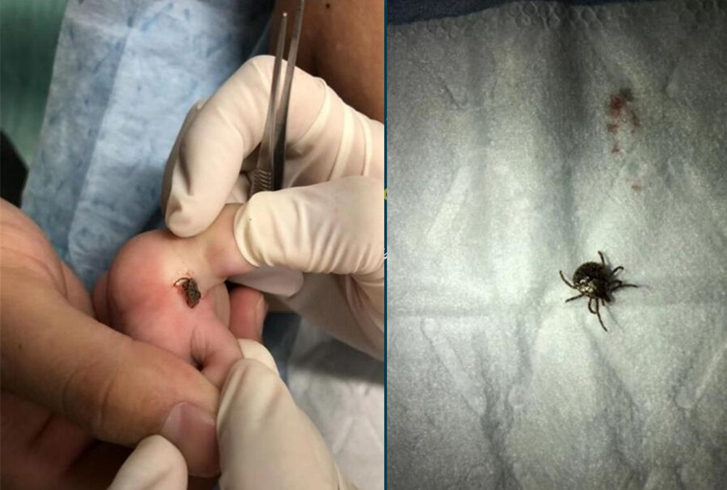 蚊虫咬了小宝宝,蚊虫咬了儿童用什么药