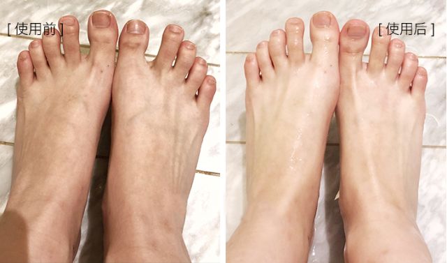 擦掉一块皮用什么药,擦掉了一小块皮一般需要多久恢复