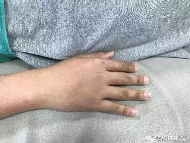 世界杯运动员受伤怎么处理,世界杯球员受伤对方球员赔偿吗