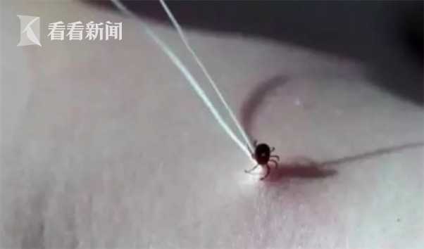 夺命蜱虫,蜱虫咬人一家几口死亡事件
