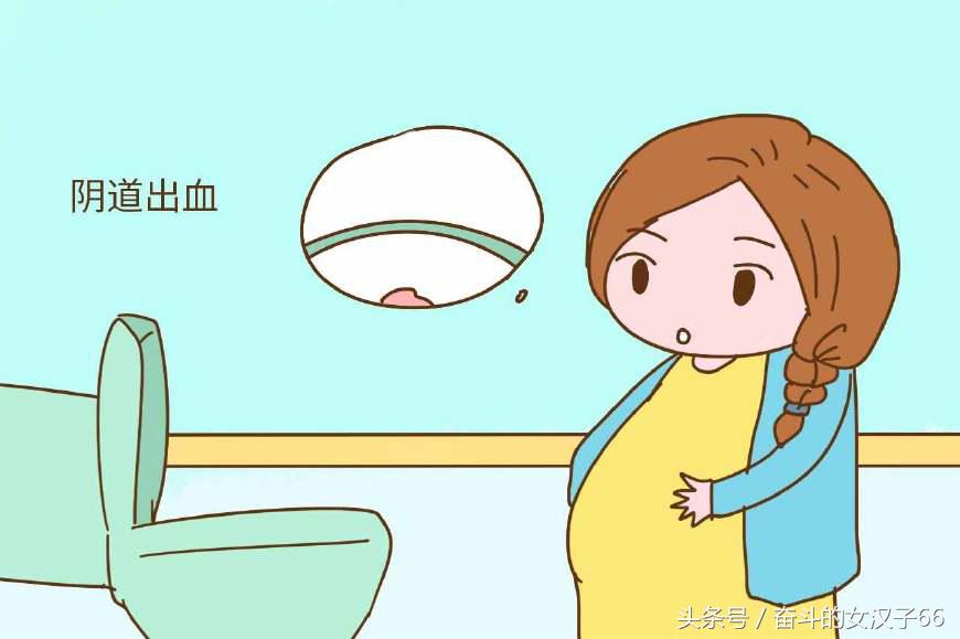 孕期出现5种明显表现,孕妇最简单有效判断胎儿安危办法