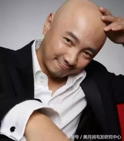 大额头怎么拥有完美发际线,发际线干货分享