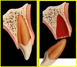怎么拯救牙齿最快最有效,如何拯救牙齿