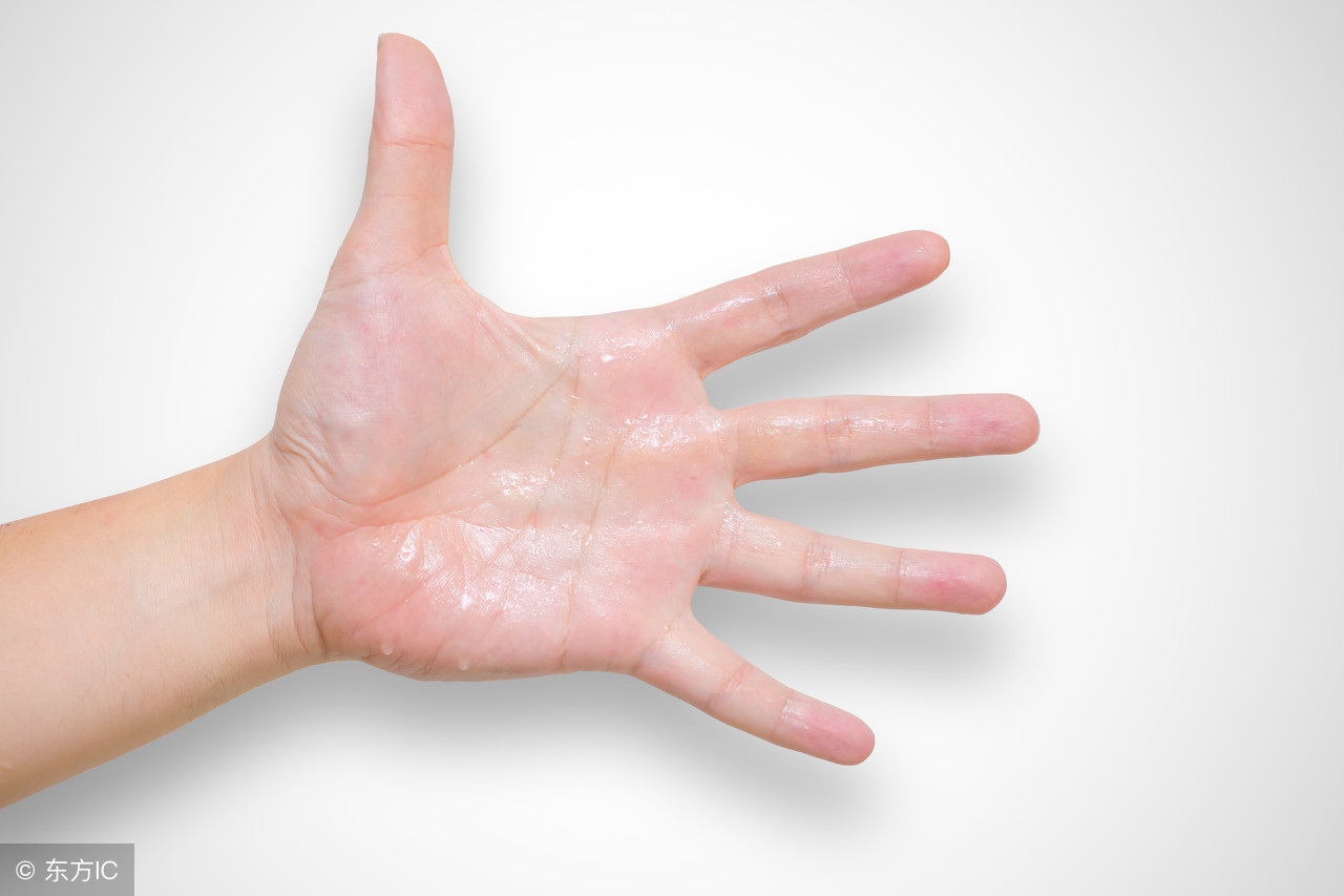 手上总是湿漉漉可能患上多汗症，微创手术可缓解