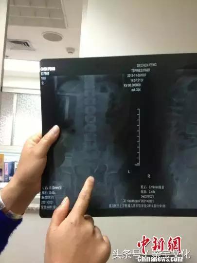2岁女宝吐了十几次,2岁儿童一天吐10次