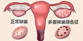 大姨妈期间促进经血排出,大姨妈期间如何保持经血通畅