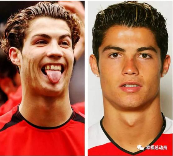 c罗容貌的变化,c罗整牙颜值变化