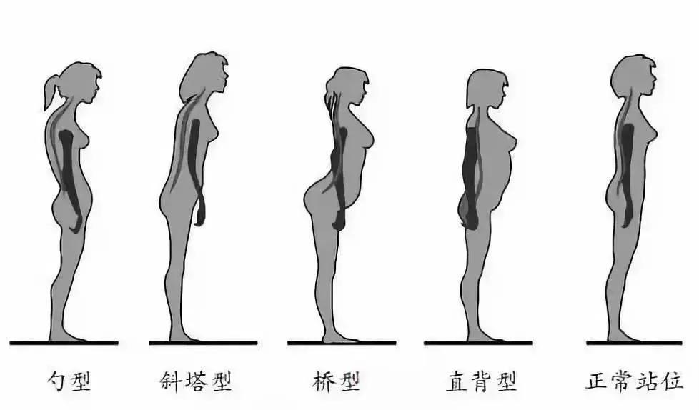 女人怎样锻炼能让背变薄,背痛可以做什么操