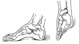 万恶的陋习——缠足,你到底从何时兴起?