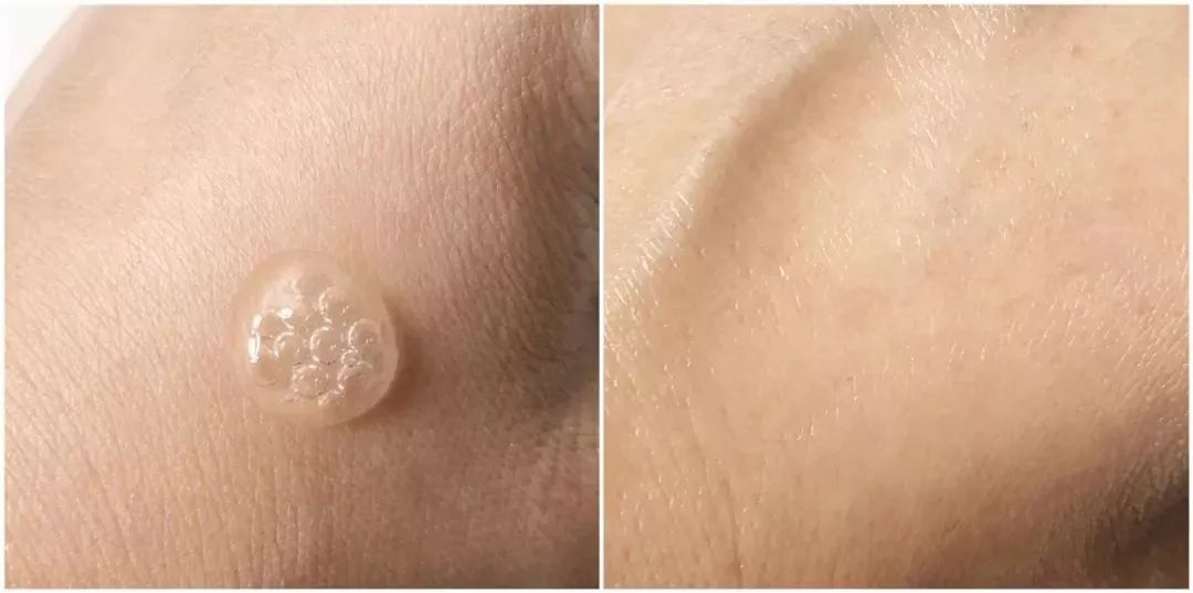 润百颜功效及作用介绍,润百颜哪个系列好用