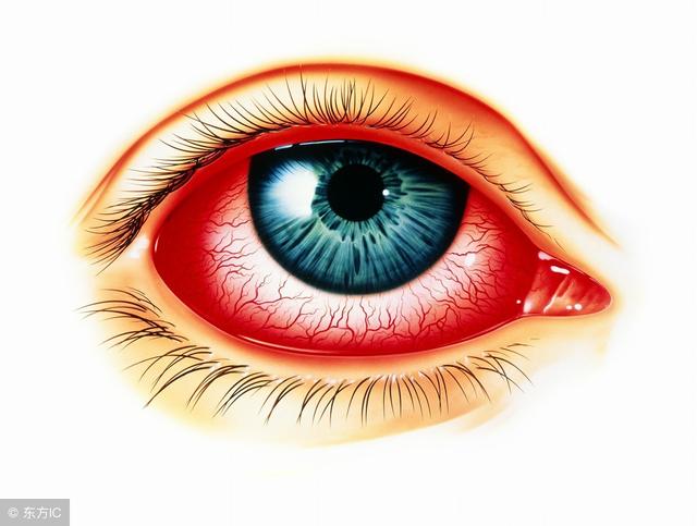 得了结膜炎可以自愈吗,春天过敏性结膜炎高发该怎么办