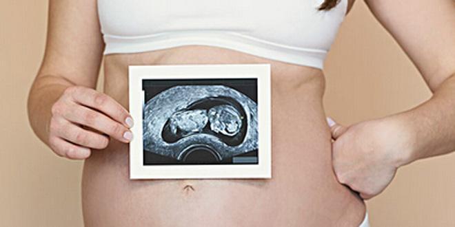 孕妇做B超需要准备什么,孕妇做b超需要注意事项