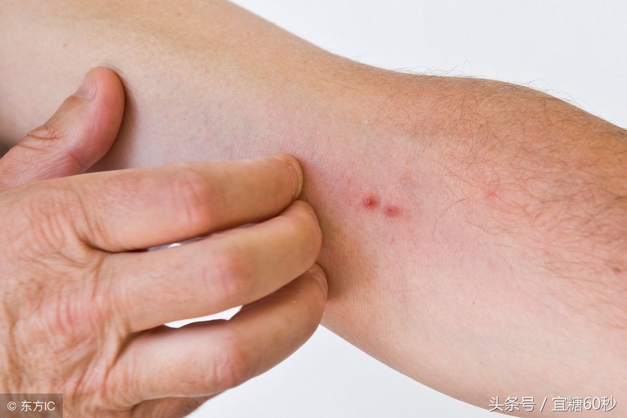 糖尿病十大危险的信号,糖尿病患者危险的五大信号